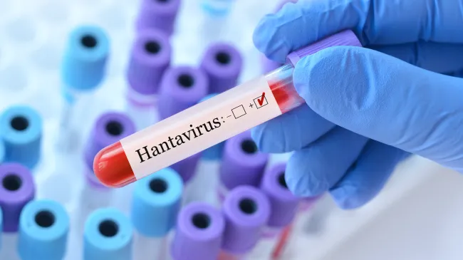 Hantavirus
