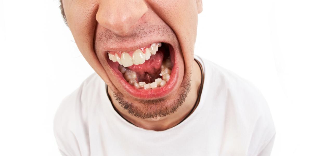 The Lunatic Core of Radical Legal Egalitarianism The Lunatic Core of Radical Legal Egalitarianism